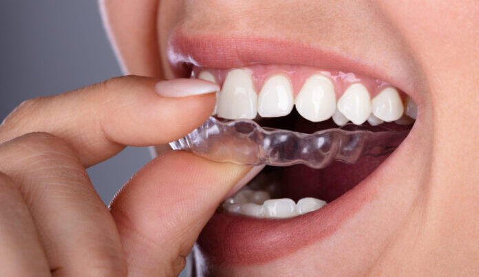 Pros and Cons of Invisible Aligners