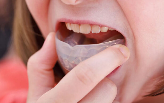 Boil-and-Bite Mouthguards