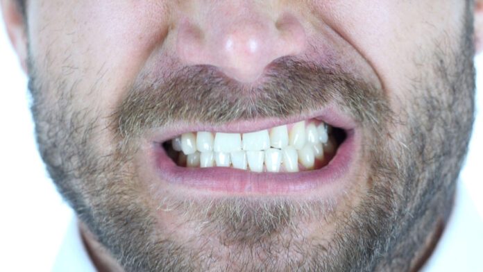 What Are Night Guards, and How Do They Help with Nocturnal Bruxism