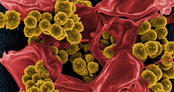 Bacterial biofilms