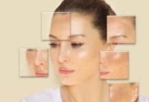 What Treatments Do Melasma Clinics Use to Fade Dark Patches?