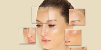 What Treatments Do Melasma Clinics Use to Fade Dark Patches?
